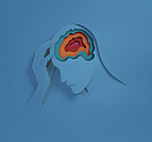 Headache,conceptual image