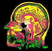 Human head and brain,sagittal MRI scan