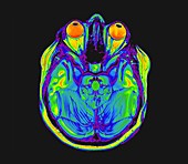 Human eyes and brain,MRI scan