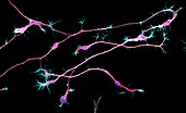 Neurons from stem cells,fluorescence light micrograph