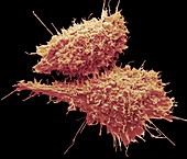 MLV infected cells,SEM
