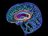 Human brain and limbic system,3D MRI-based image