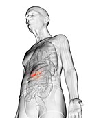 Illustration of an elderly man's gallbladder