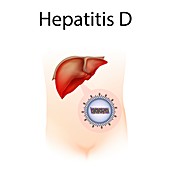 Hepatitis D,illustration
