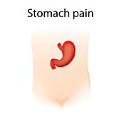 Stomach pain,illustration