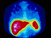 F/colour gamma scan of normal human liver & spleen