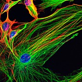 Astrocyte brain cells, confocal light micrograph