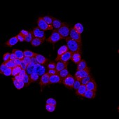 Mitosis, confocal light micrograph