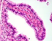 Fallopian tube mucosa, light micrograph