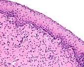 Vaginal mucosa, light micrograph