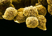 Pancreatic cancer cell, SEM