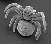 Newly hatched spiderling, SEM