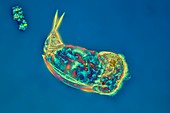 Rotifer Cephalodella sp, light micrograph