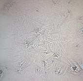 Human salivary ferning, light micrograph
