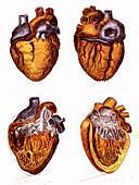 Heart anatomy, 19th century