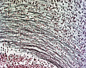 Spinal cord nerve cells, light micrograph