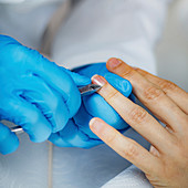 Removing fingernail cuticles