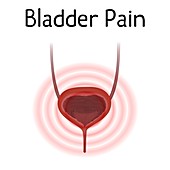 Bladder pain, illustration