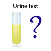 Urinary sample, illustration