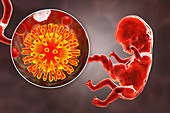 HIV infecting human embryo, illustration