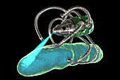 Medical nanorobot fighting with bacterium, illustration