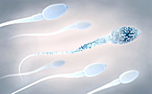 Damaged sperm, illustration