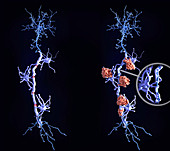 Healthy neurons and nerve damage in multiple sclerosis