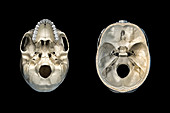Human skull cross-sections, illustration