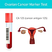 Ovarian cancer blood test, illustration