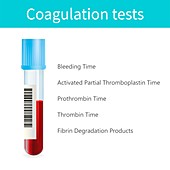 Coagulation tests, illustration