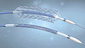 Stents and balloon catheters, illustration