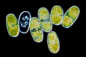 Penium silvae nigrae green alga, light micrograph