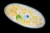 Ciliate protozoan, light micrograph