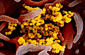 Covid-19 coronavirus particles, SEM