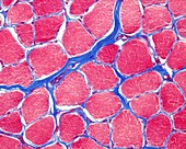 Skeletal striated muscle, light micrograph