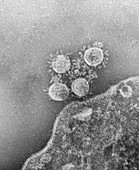 Covid-19 coronavirus, TEM