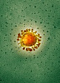 Covid-19 coronavirus, TEM