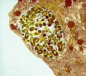 Chlamydia bacteria in a lung cell, TEM