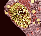 Chlamydia bacteria in a lung cell, TEM