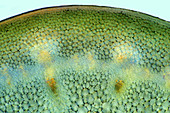 Broccoli, polarised light micrograph