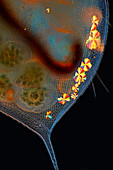 Daphnia with embryos and carapace crystals, light micrograph