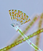 Meridion circulare diatoms, light micrograph