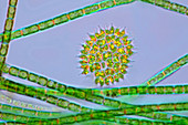 Pediastrum and filamentous green algae, light micrograph
