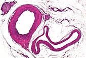 Mammal muscular artery, veins and nerves, light micrograph