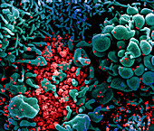 Covid-19 coronavirus particles, SEM