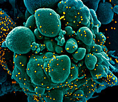 Cell infected with Covid-19 coronavirus particles, SEM