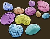 Foraminifera, SEM