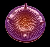 Diatom, SEM