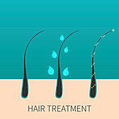 Hair follicle after treatment, illustration