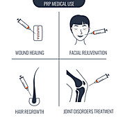 PRP medical use, illustration